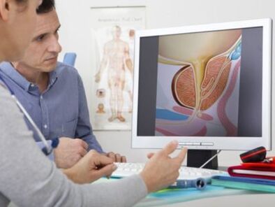 Urologas konsultuoja pacientą dėl potencijos problemų